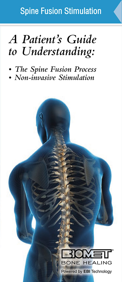 Spine Fusion Stimulation
