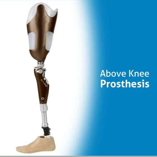 Below Knee Prosthesis