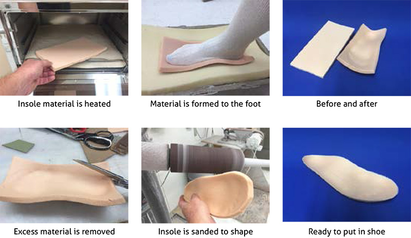 Ankle Foot Orthosis