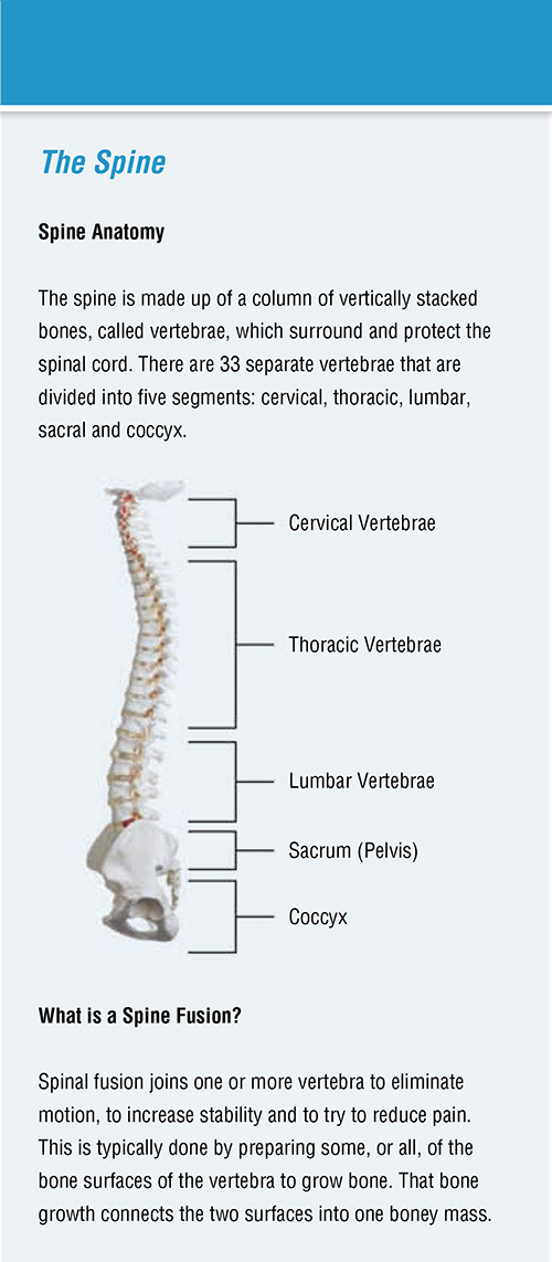 Spine Fusion Stimulation