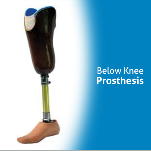 Below Knee Prosthesis